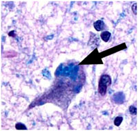 Text Box:      In storage diseases, the cells recycling systems, the lysosome, cannot break down worn out proteins.  These worn out molecules build up in the cell until they interfere with its function. The arrow points to material that has built up in the brain cell of a dog that has died of a storage disease.  